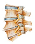 The Commonly UN-Addressed Contributor  Of Spinal Degeneration?
